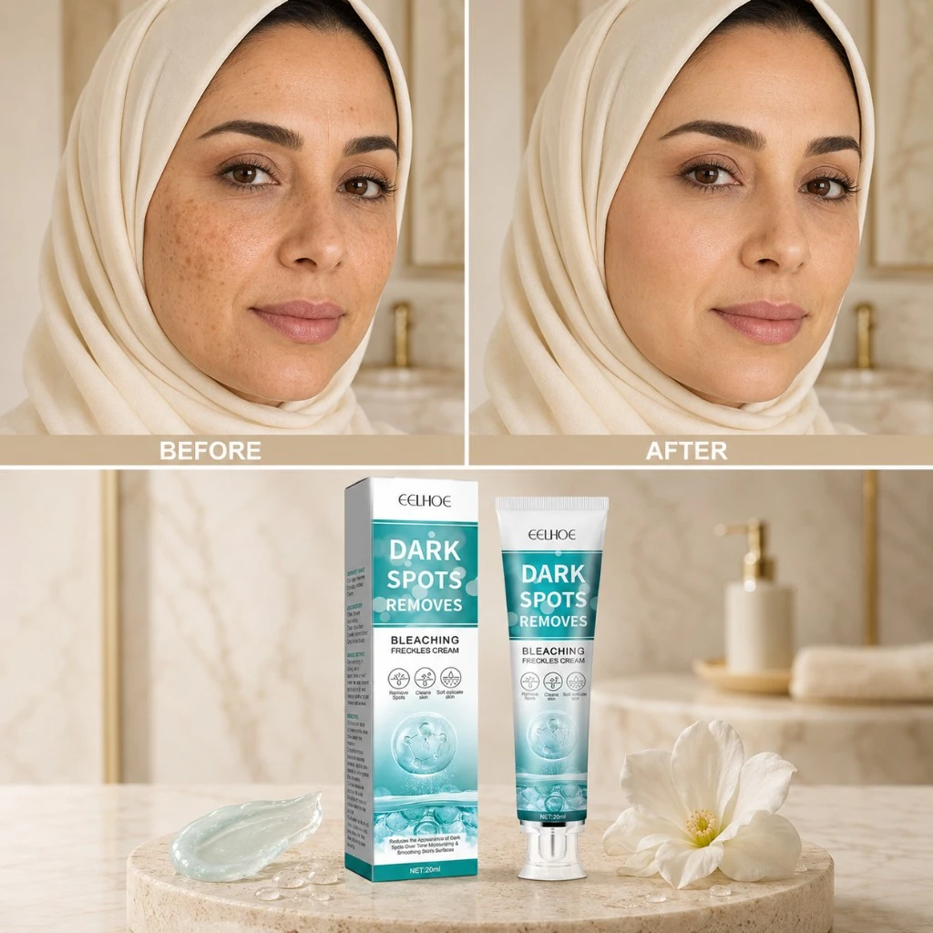 كريم البقع الداكنة